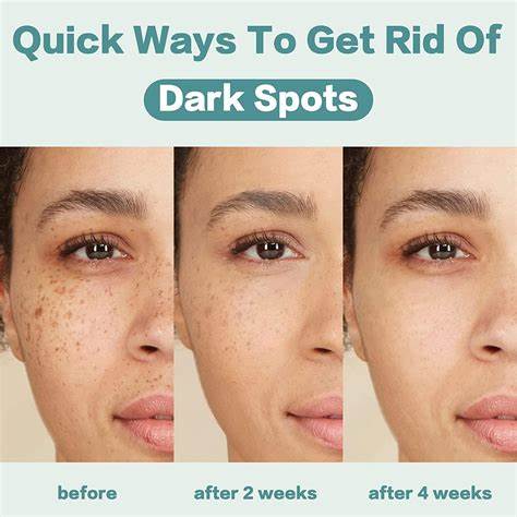 Dark Spot Serum for Sensitive Skin