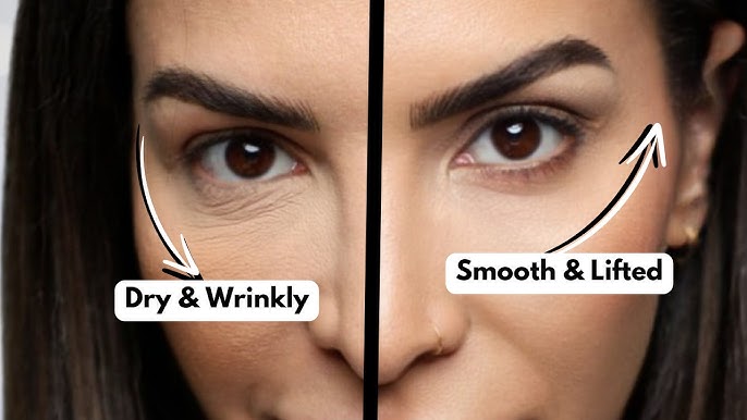 Wrinkle removal Niacinamide Serum