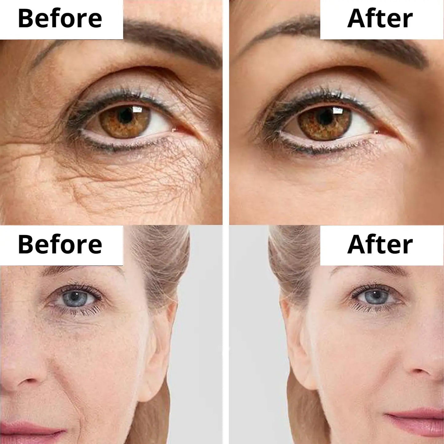 Anti Aging Moisturizer for Sensitive Skin